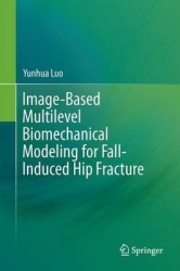 Image-Based Multilevel Biomechanical Modeling for Fall-Induced Hip Fracture