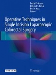 Operative Techniques in Single Incision Laparoscopic Colorectal Surgery