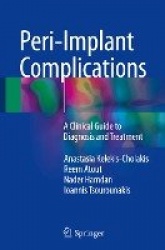 Peri-Implant Complications : A Clinical Guide to Diagnosis and Treatment