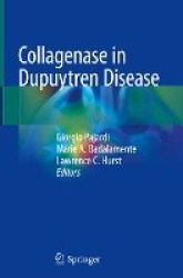 Collagenase in Dupuytren Disease
