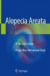 Alopecia Areata : A Clinician's Guide