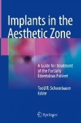 Implants in the Aesthetic Zone - A Guide for Treatment of the Partially Edentulous Patient