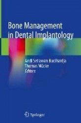 Bone Management in Dental Implantology