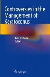 Controversies in the Management of Keratoconus