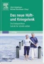 Das neue Hüft- und Kniegelenk : Die Endoprothese Schritt für Schritt erklärt