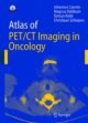 Atlas of Pet/Ct Imaging in Oncology: Atlas of PET
