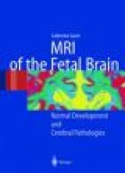 MRI of the Fetal Brain - Normal Development and Cerebral Pathologies