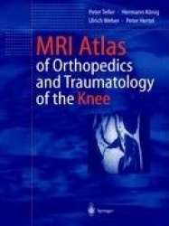 MRI Atlas of Orthopedics and Traumatology of the Knee