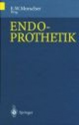Endoprothetik