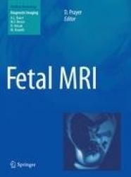 Fetal MRI
