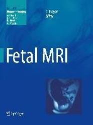 Fetal MRI