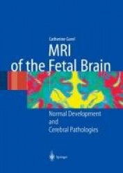 MRI of the Fetal Brain : Normal Development and Cerebral Pathologies