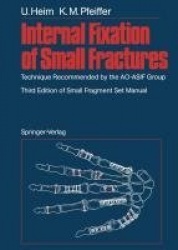 Internal Fixation of Small Fractures - Technique Recommended by the AO-ASIF Group