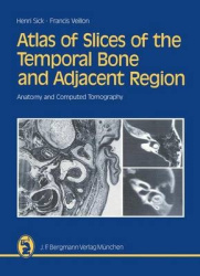 Atlas of Slices of the Temporal Bone and Adjacent Region - Anatomy and Computed Tomography Horizontal, Frontal, Sagittal Section