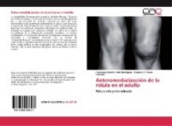 Anteromedialización de la rótula en el adulto