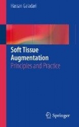 Soft Tissue Augmentation : Principles and Practice