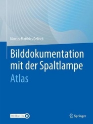 Bilddokumentation mit der Spaltlampe : Atlas