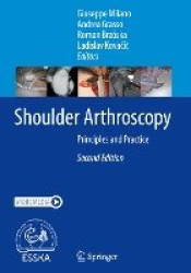 Shoulder Arthroscopy : Principles and Practice
