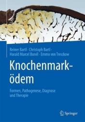 Knochenmarködem : Formen, Pathogenese, Diagnose und Therapie
