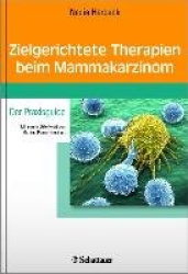 Zielgerichtete Therapien beim Mammakarzinom
