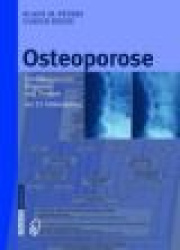 Osteoporose : Leitliniengerechte Diagnostik und Therapie mit 25 Fallbeispielen