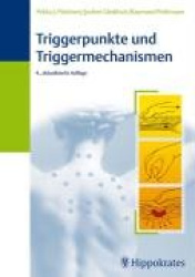 Triggerpunkte und Triggermechanismen
