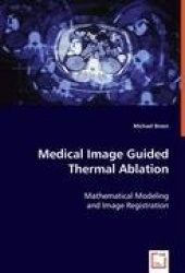 Medical Image Guided Thermal Ablation