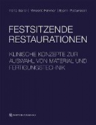 Festsitzende Restaurationen