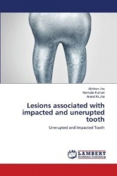 Lesions associated with impacted and unerupted tooth