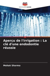 Aperçu de l'irrigation - La clé d'une endodontie réussie