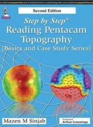 Step by Step: Reading Pentacam Topography - (Basic and Case Study Series)