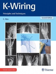 K-Wiring - Principles and Techniques