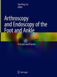 Arthroscopy and Endoscopy of the Foot and Ankle - Principle and Practice