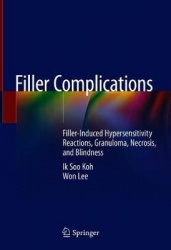 Filler Complications - Filler-Induced Hypersensitivity Reactions, Granuloma, Necrosis, and Blindness