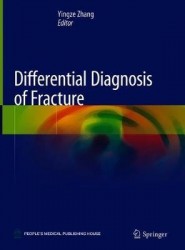 Differential Diagnosis of Fracture