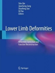 Lower Limb Deformities - Deformity Correction and Function Reconstruction