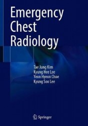 Emergency Chest Radiology
