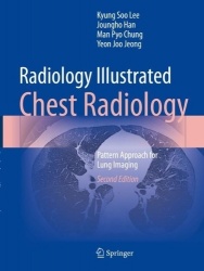 Radiology Illustrated: Chest Radiology - Pattern Approach for Lung Imaging