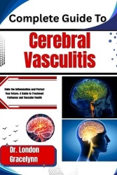 Complete Guide To Cerebral Vasculitis