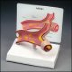 Artery Section Model