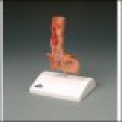 Diseases of Esophagus Model