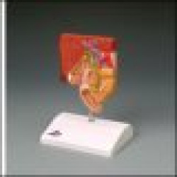 Gallstone Model