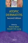 Atopic Dermatitis