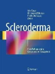 Scleroderma
