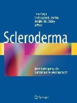 Scleroderma : From Pathogenesis to Comprehensive Management