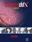 EXPERTddx: Chest