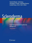 Scleroderma - From Pathogenesis to Comprehensive Management